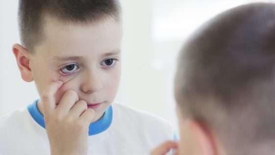 5 أسباب لكذب الأطفال